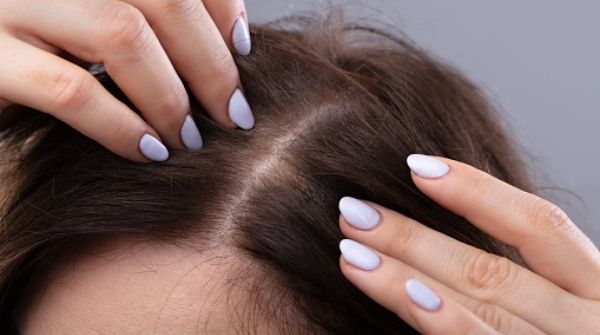 Castor oil for hair reduces the chances of thin hair. Because it leads to hair growth and disinfect the scalp as well. 