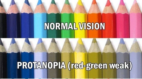Name of the disease is color blindness. Symptoms of eye are difficult to differentiate between two colors. 